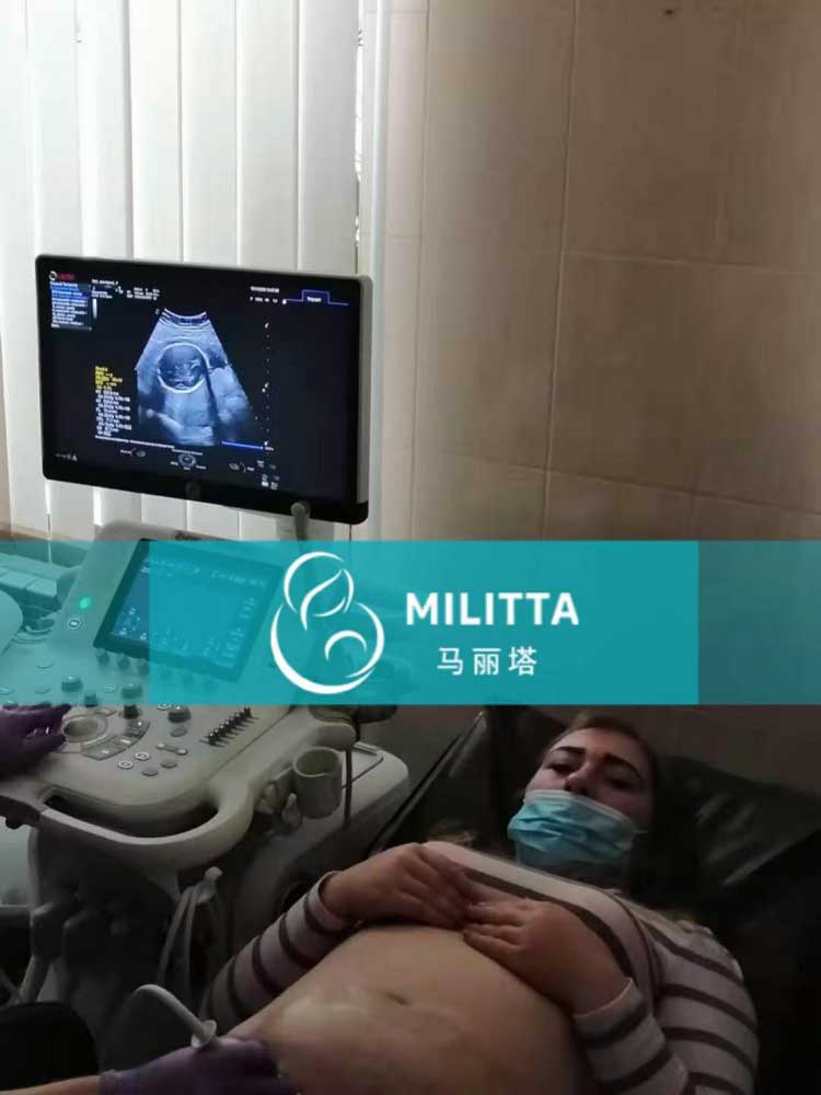 乌克兰代妈孕18周做产检
