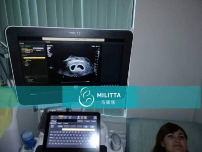 乌克兰试管孕妈做第一次B超确定胚胎着床
