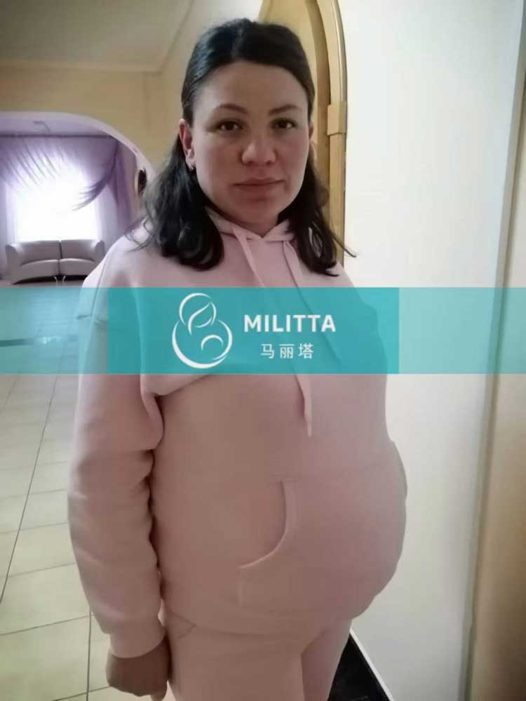 乌克兰孕33周孕妈做B超