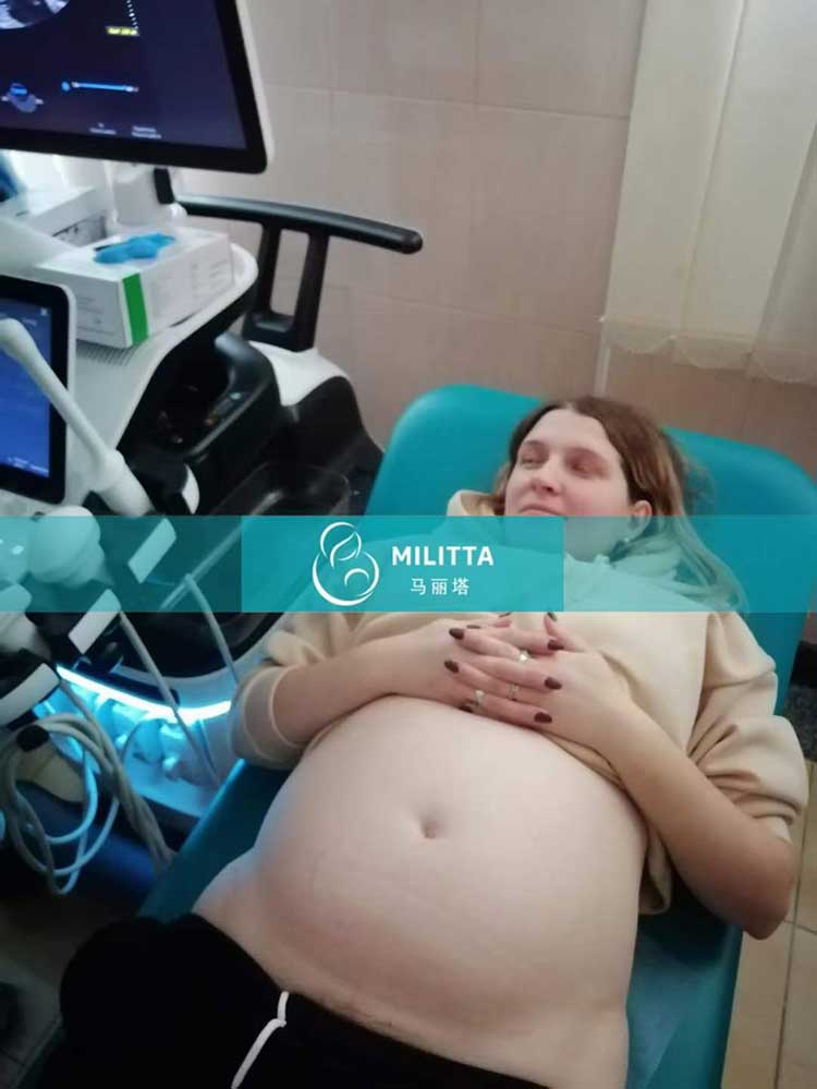 乌克兰试管妈妈孕24周B超产检
