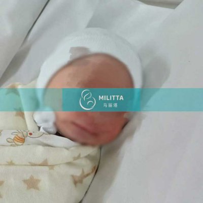 Z夫妇在乌克兰A丽塔医院试管助孕的的男宝宝顺利出生
