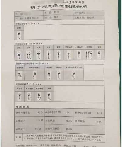 精子形态学检测报告