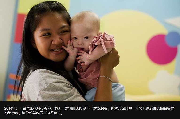 泰国代妈抱起患有唐氏综合症的婴儿