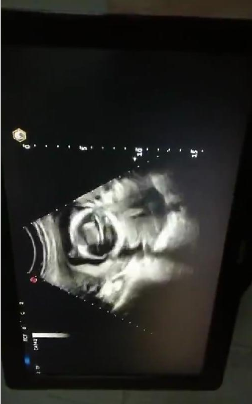 代母日常体检,这可能是所有妈妈的紧张时刻