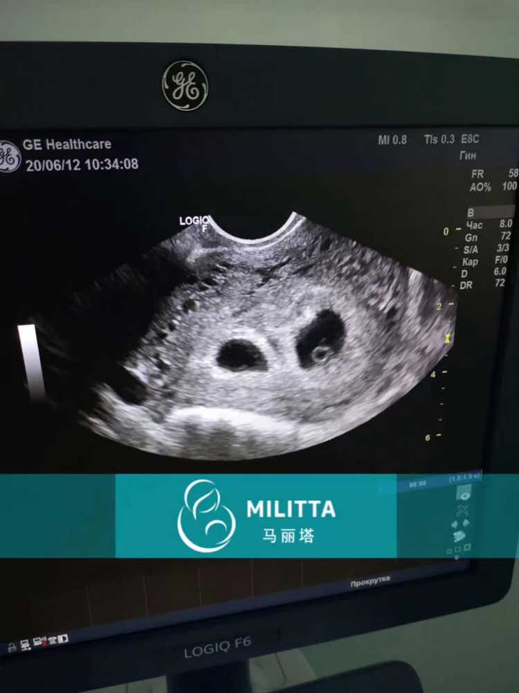 乌克兰马丽塔代妈素质