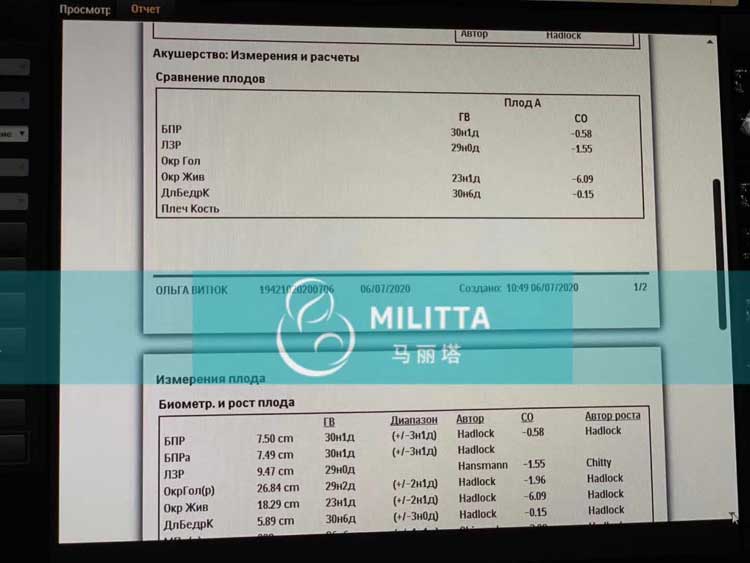 乌克兰代妈到医院做四维彩超