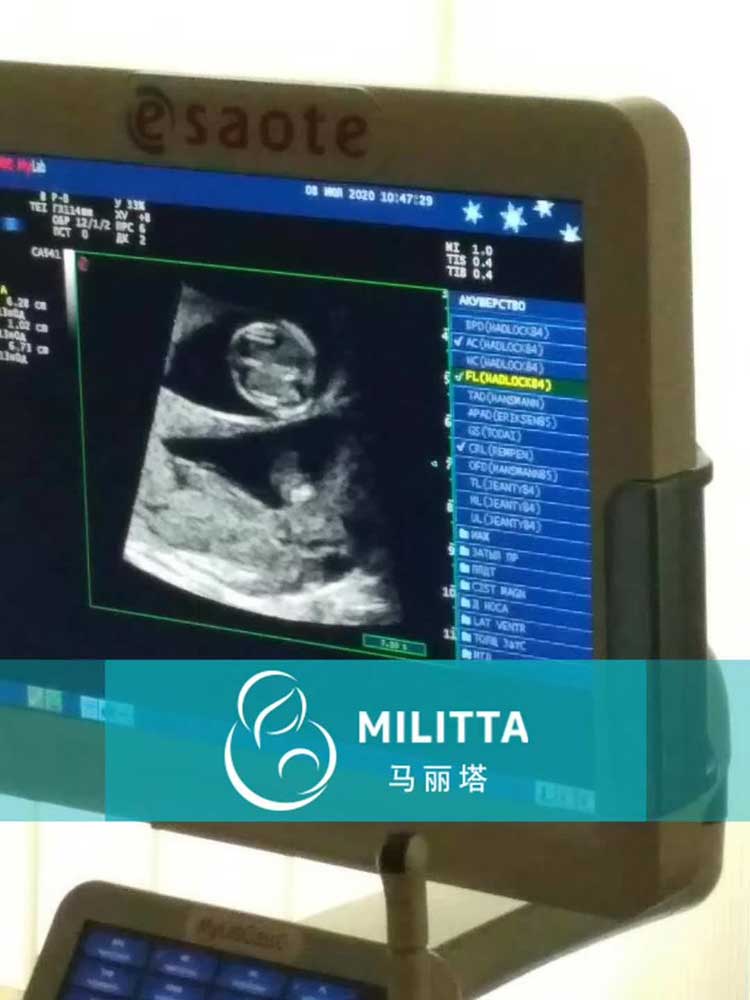陪同乌克兰代妈做B超