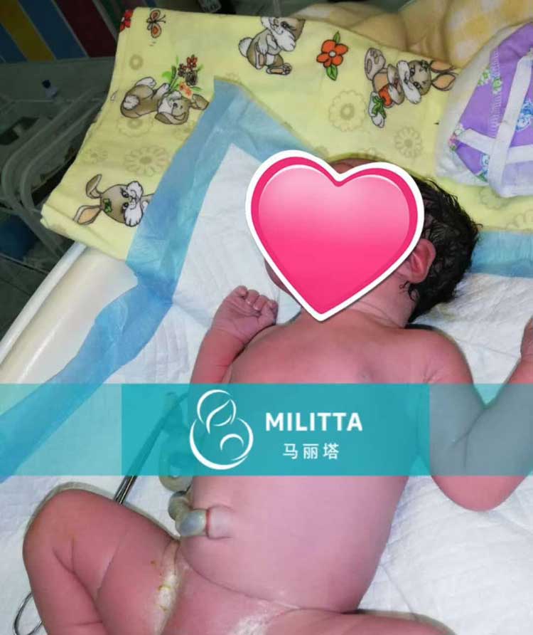乌克兰顺利为X先生家庭试管诞下小千金一枚