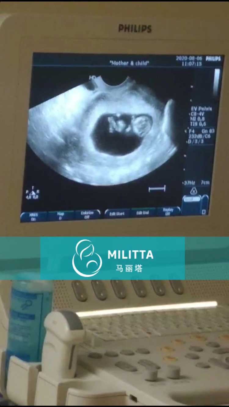 乌克兰代妈做产检