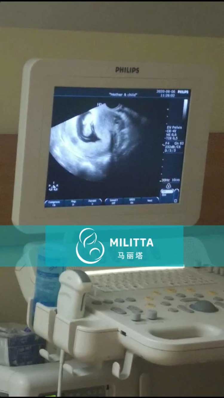 乌克兰代妈做产检