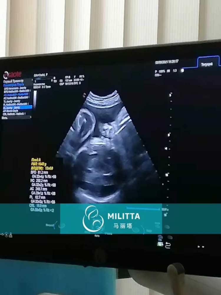 乌克兰试管孕妈产检