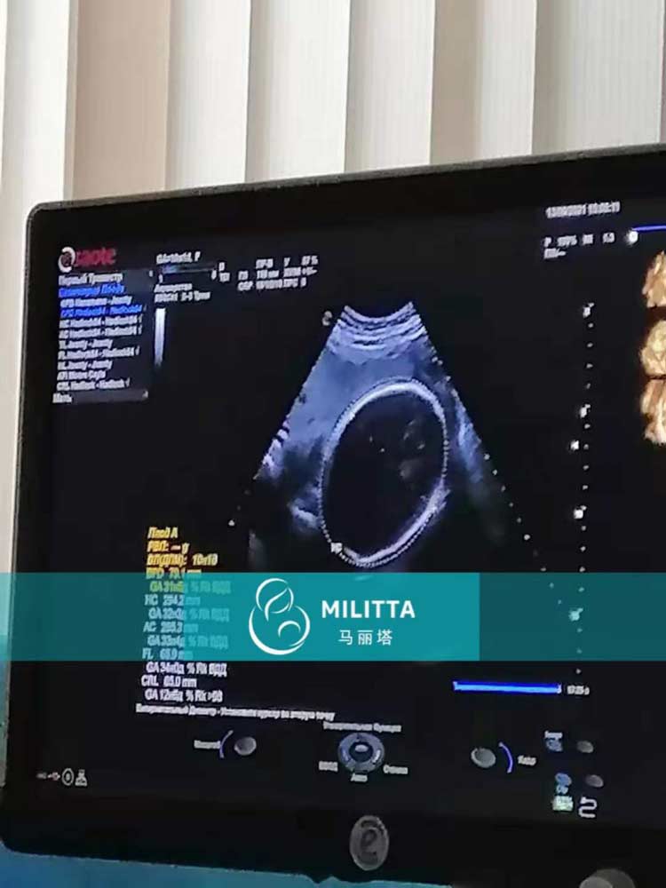 乌克兰孕妈做产检