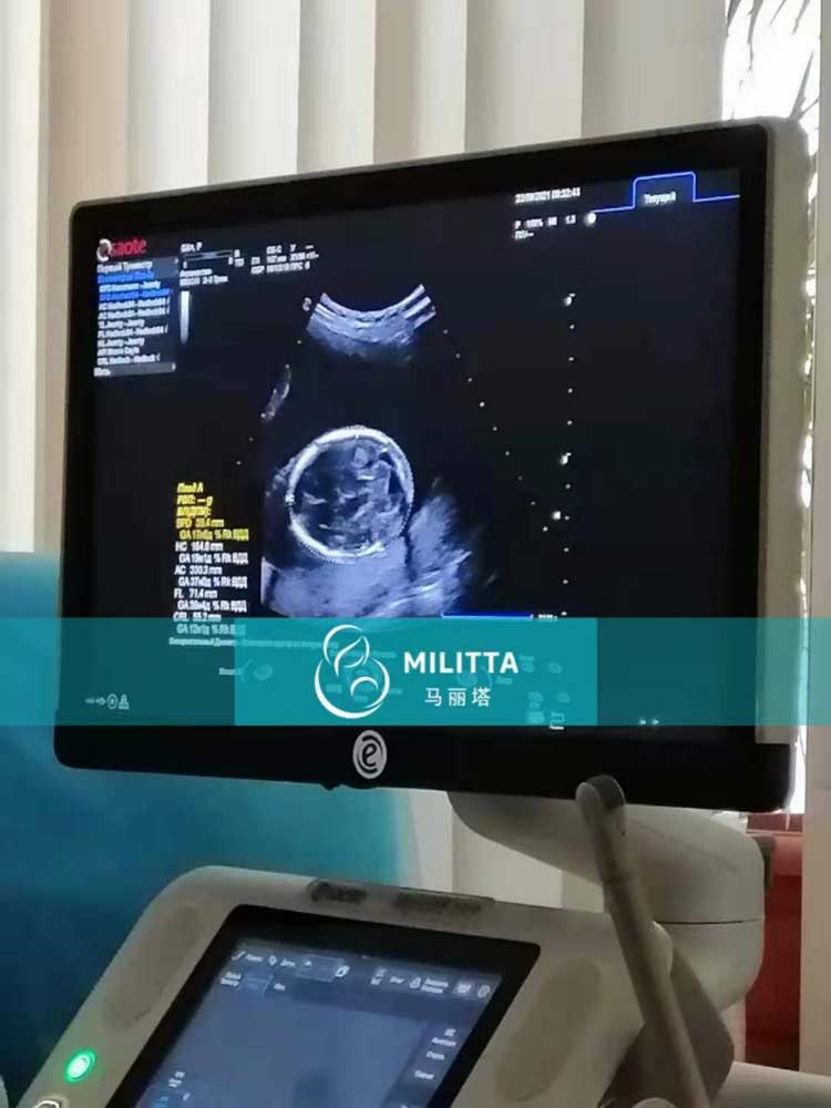 乌克兰孕妈做产检