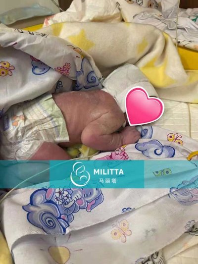 捐卵包成功Z夫妇家的孩子出生,夫妻俩经历许多
