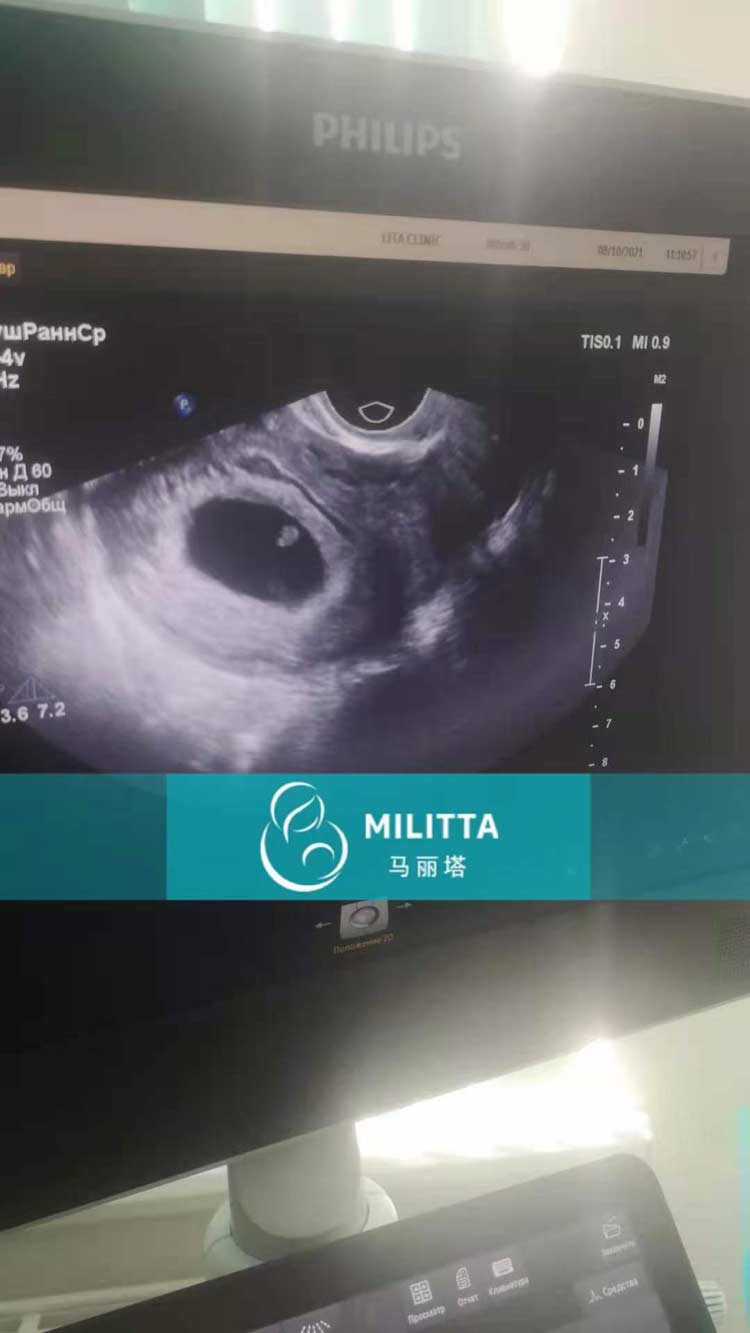 乌克兰孕妈做产检