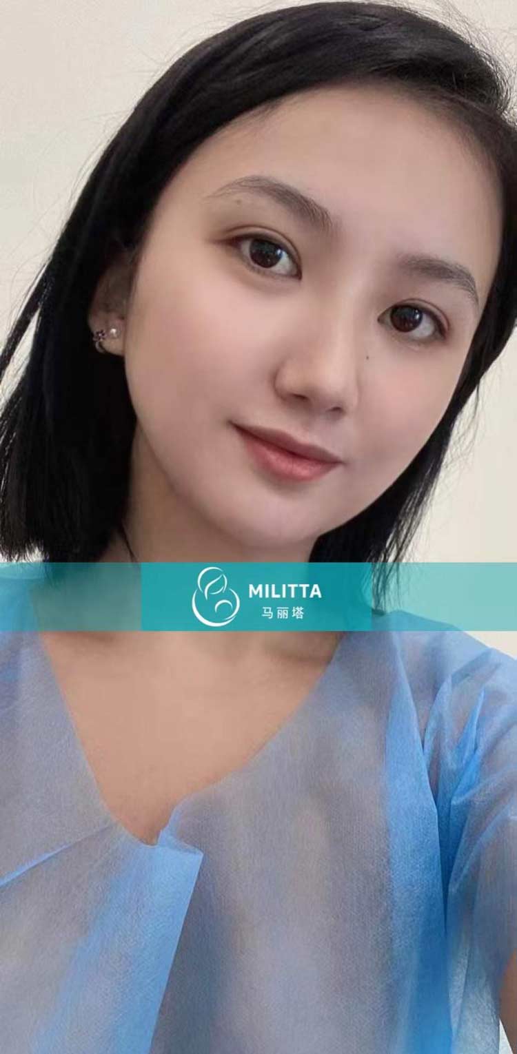 马丽塔亚裔卵妹取卵