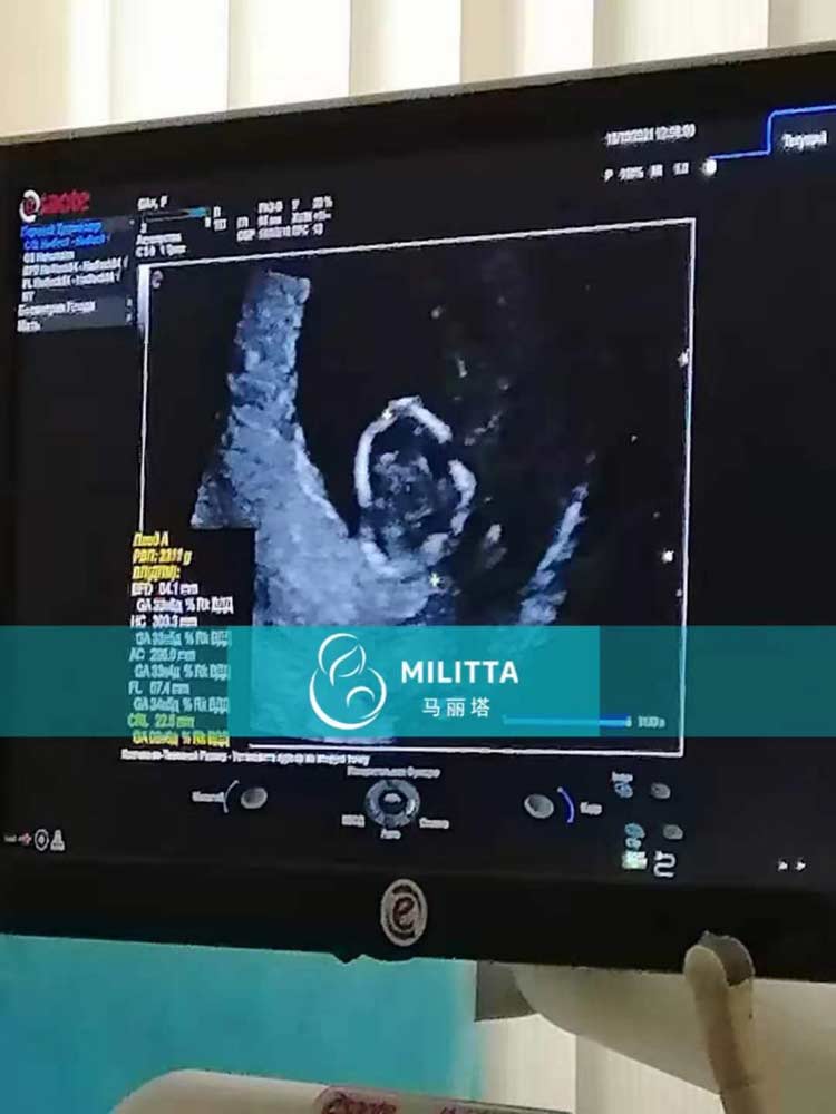 乌克兰孕妈做产检