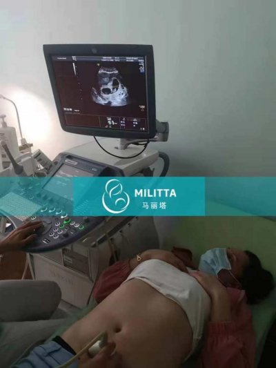 两位乌克兰按时去到医院做B超,胎儿发育情况良好