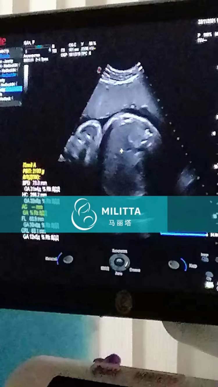 乌克兰孕妈做产检