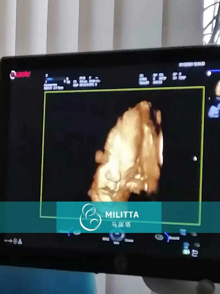 马丽塔孕母做产检