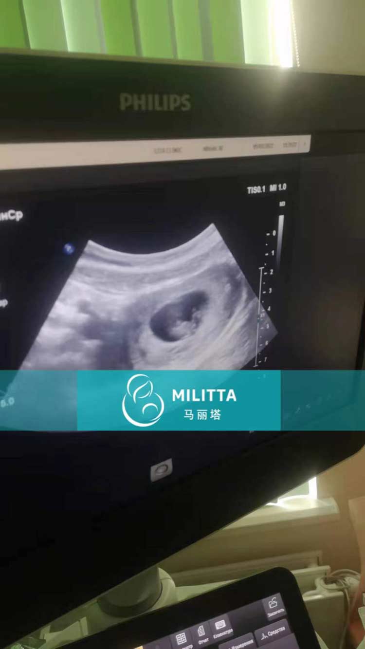 乌克兰孕妈做产检