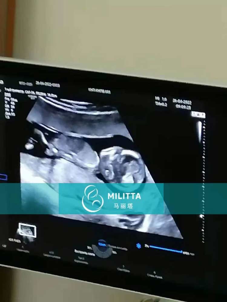 乌克兰孕妇做B超