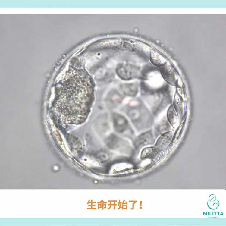 丽塔医院移植囊胚时间