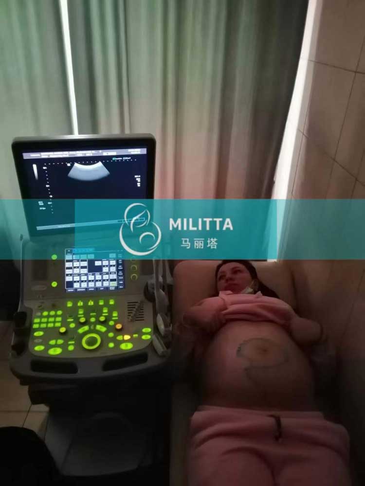 乌克兰孕33周孕妈做B超
