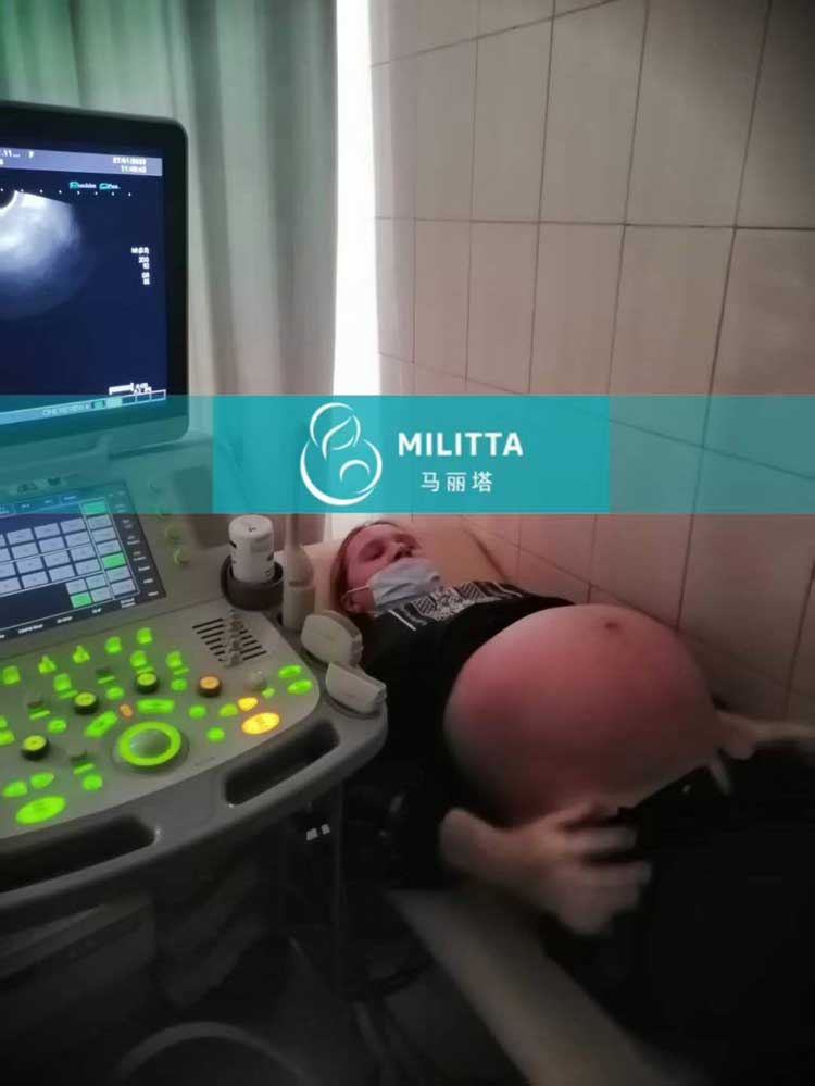 乌克兰孕34周孕妈做B超