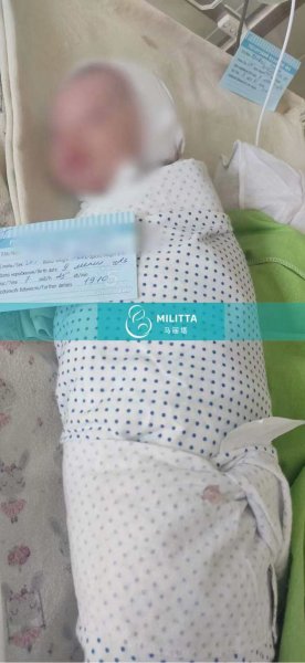 乌克兰的又一对试管双胞胎男宝顺利出生,38周的宝宝