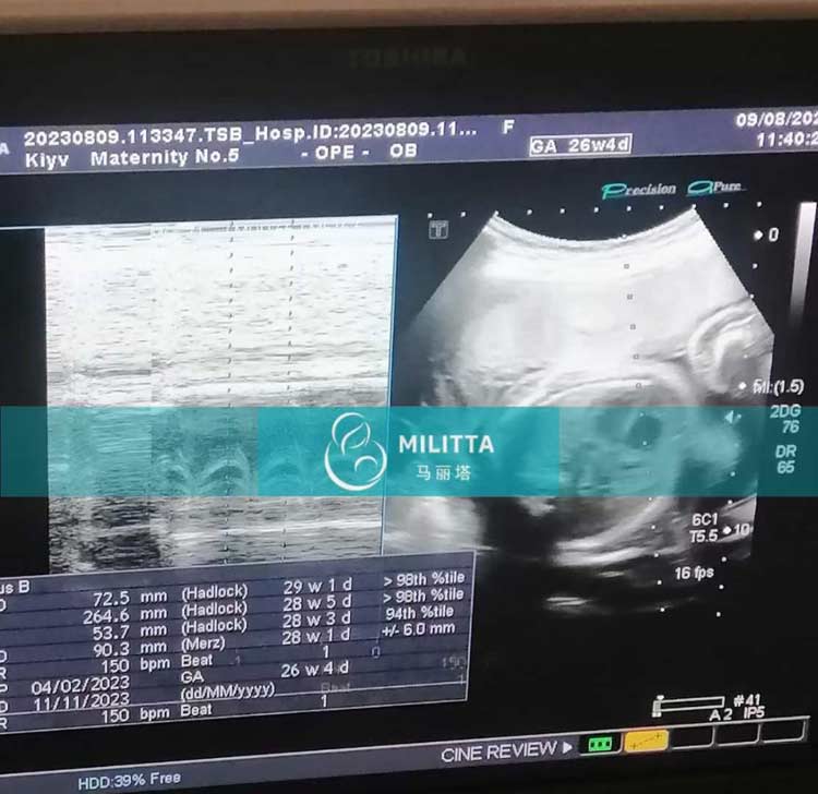 不同孕期的乌克兰试管妈妈做B超