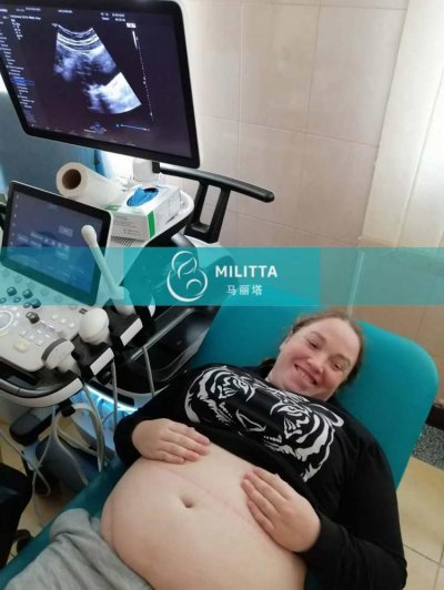 丽塔医院试管助孕的Y夫妇的乌克兰试管妈妈来做B超产检