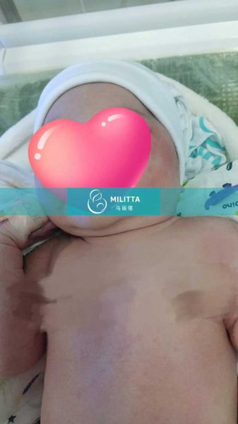 乌克兰丽塔客户的女宝宝足月出生,宝贝体重达7斤多
