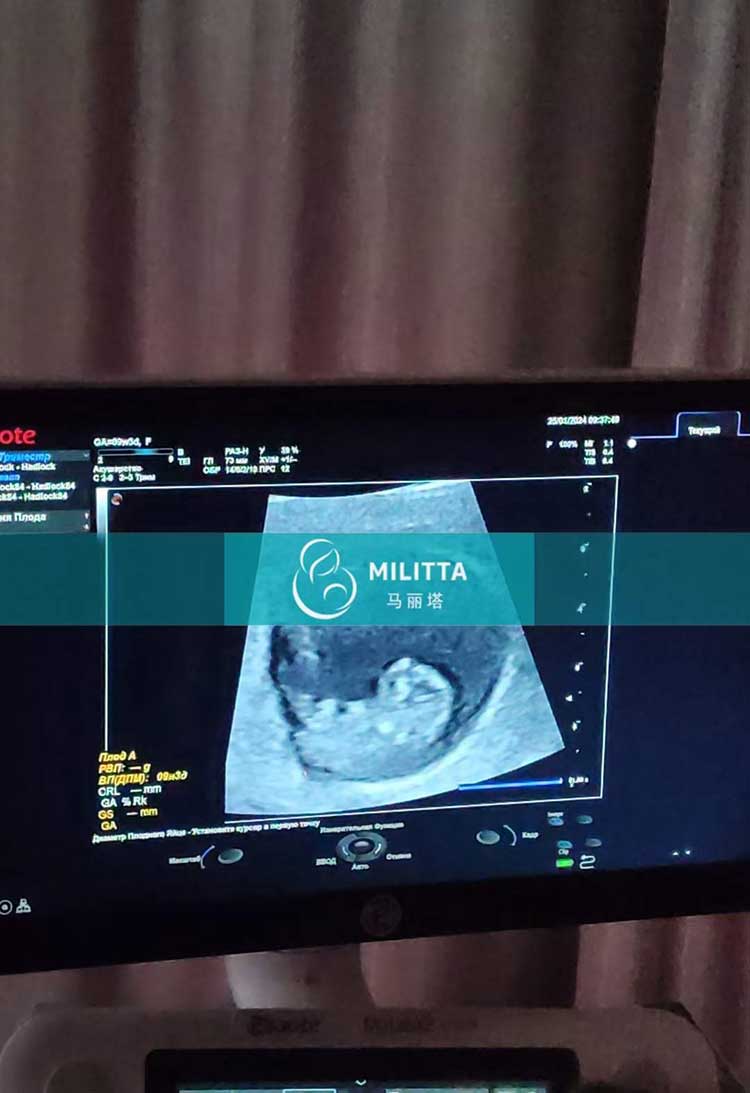 乌克兰试管妈妈产检