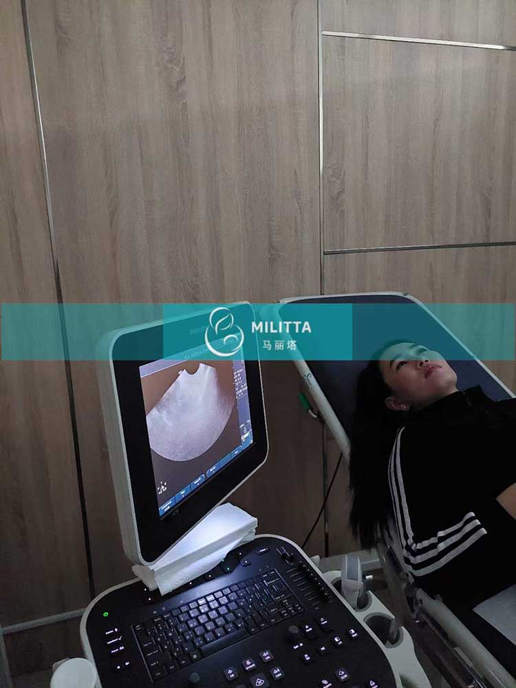 哈萨克斯坦试管妈妈检查身体