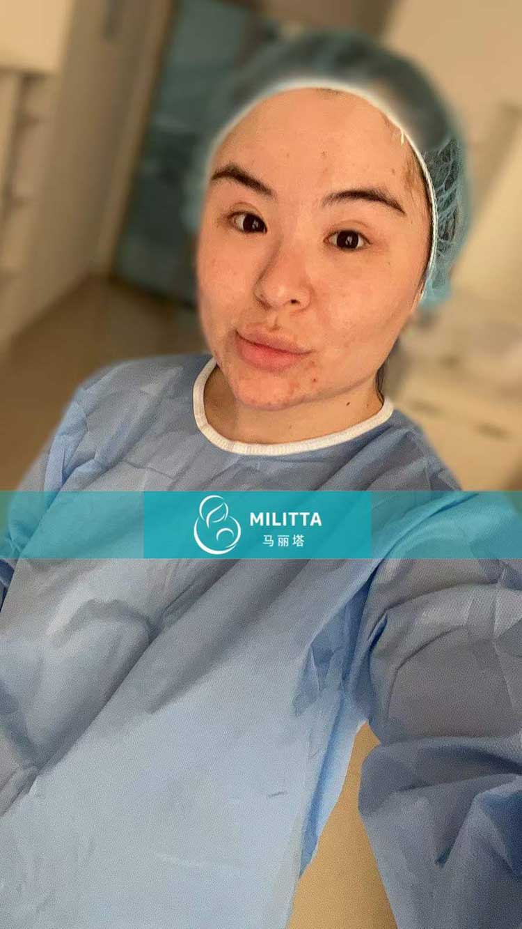 哈萨克斯坦试管妈妈