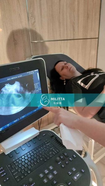 两位格鲁吉亚客户的试管妈妈来Silk医院做第二次B超孕检