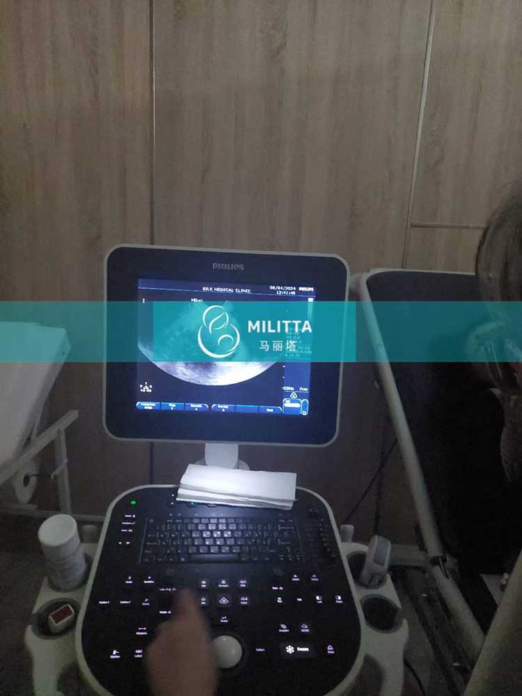哈萨克斯坦试管妈妈做B超
