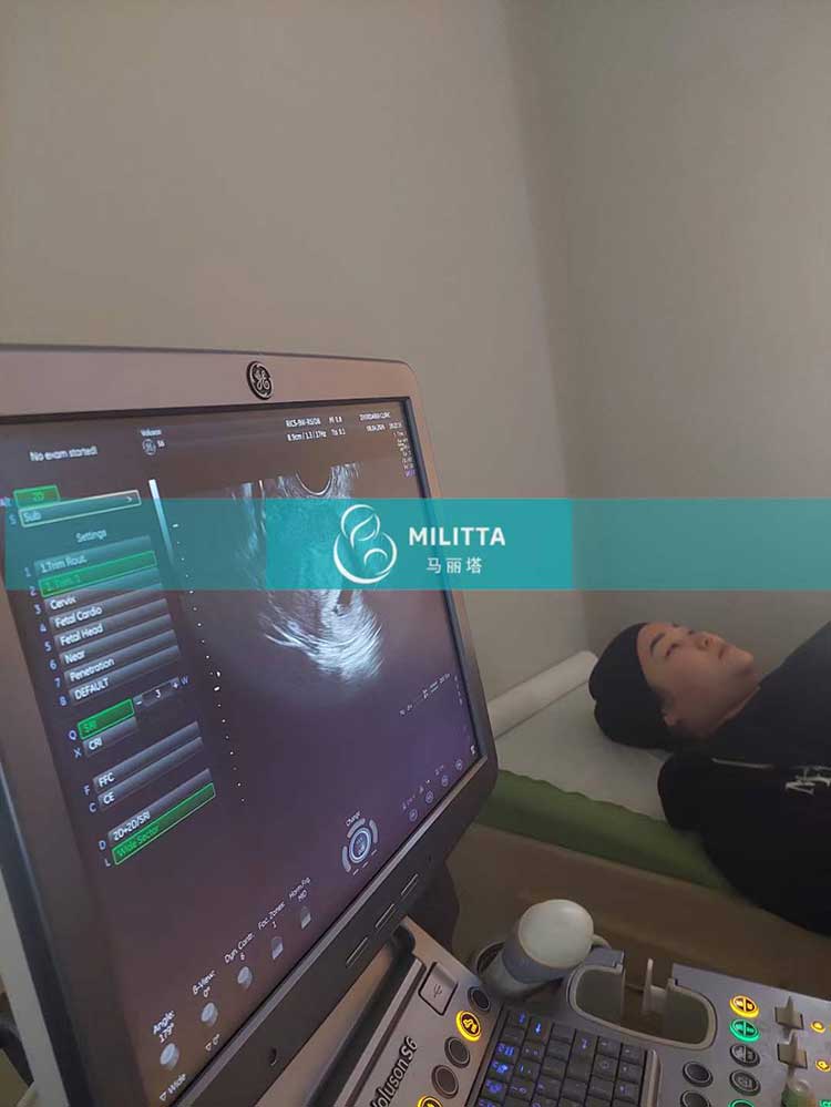 哈萨克斯坦试管妈妈B超孕检