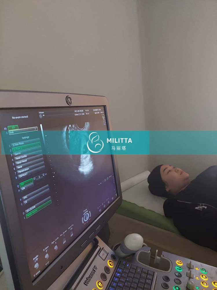 哈萨克斯坦试管妈妈B超孕检