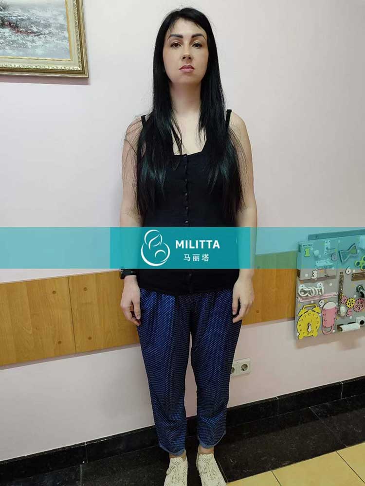 乌克兰试管妈妈四维彩超