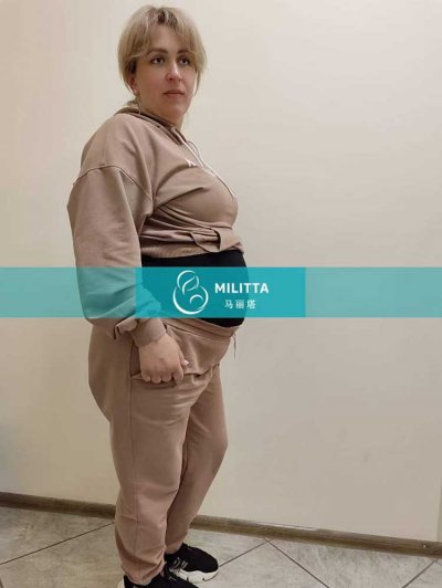 乌克兰试管妈妈在基辅做大概孕30周+B超产检，胎宝宝已经很大