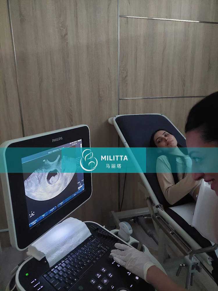 哈萨克斯坦试管妈妈做B超