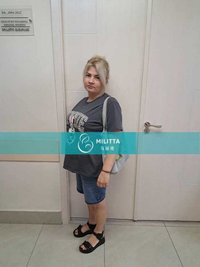 乌克兰怀男宝试管妈妈在格鲁吉亚妇产医院做24周的四维彩超