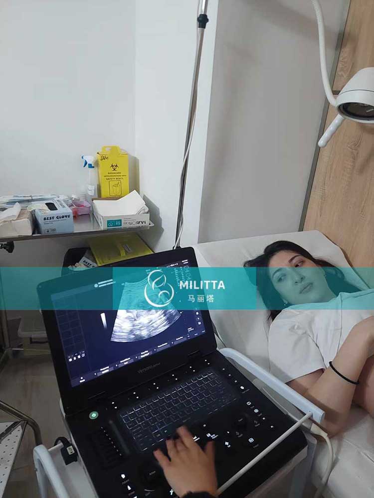 试管妈妈做B超