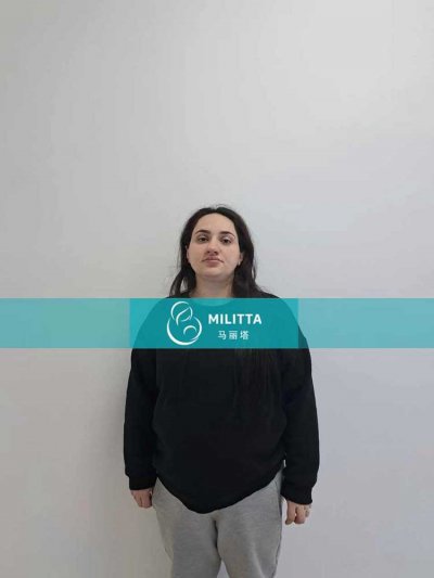 两位格鲁吉亚客户的试管妈妈做21周和23周+的四维彩超