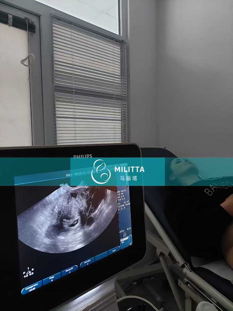 试管妈妈首次B超