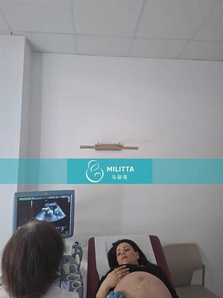 格鲁吉亚试管妈妈做四维彩超