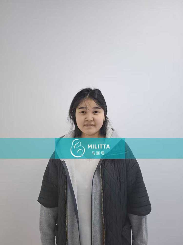 格鲁吉亚试管妈妈做四维彩超