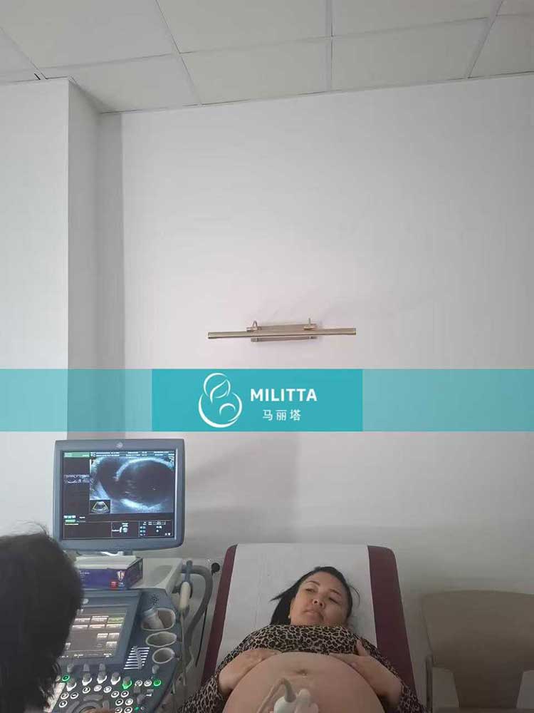 试管妈妈做B超